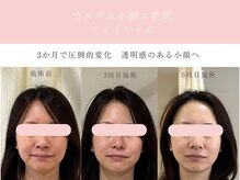 シンナリ(Shinnari)の雰囲気（結果重視　小顔×美肌フェイシャルの症例）