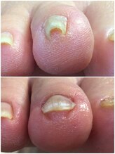 モアクリスタル(More Crystal)/