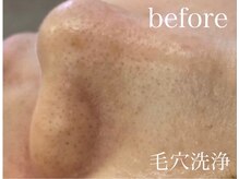 チャーム(Charm)/ビフォー