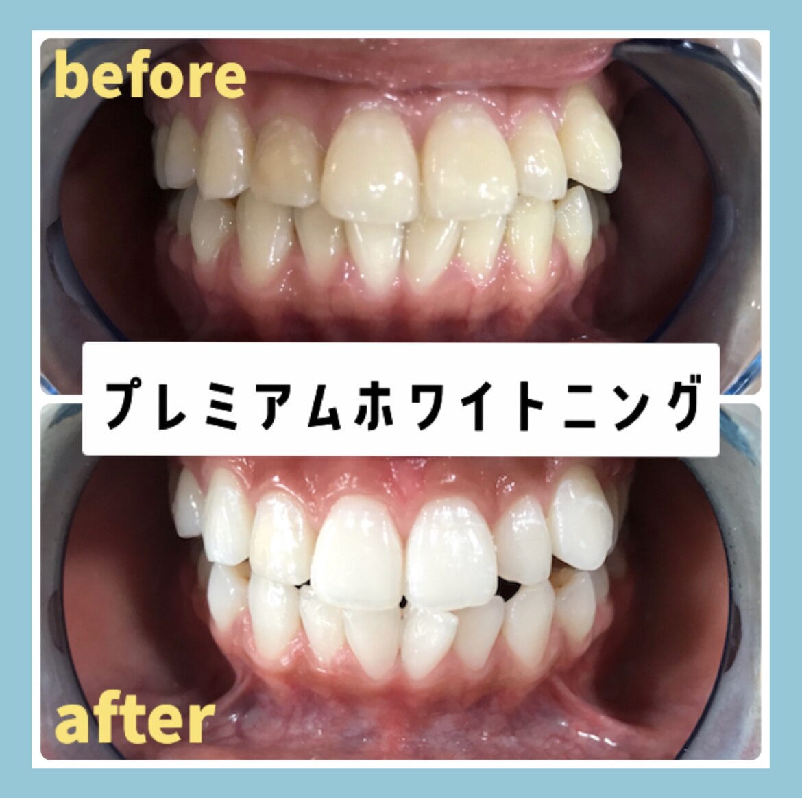 プラチナムビューティー 新宿西口本店(PLATINUM Beauty
