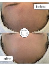 アリー(ALLY)/艶肌wax