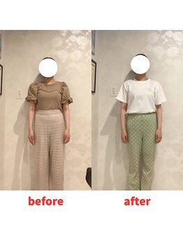 ナオル整体 福岡香椎院(NAORU整体)/20代女性施術事例【右肩下がり】