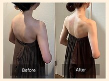 ラフリー 天神赤坂院(RUFFREE)/ブライダル整体リンパマッサージ