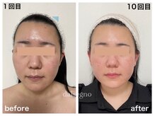 ダルセーニョ/「美人メンタル」はコルギから！