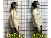 幸鍼灸整体院 武庫之荘院/整体・トレーニング・姿勢変化2