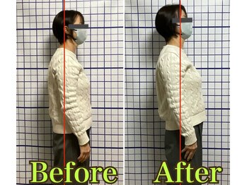 幸鍼灸整体院 武庫之荘院/整体・トレーニング・姿勢変化2