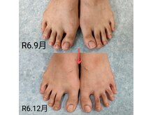 湊(みなと)の雰囲気（母趾変形、扁平足、巻爪、足のトラブルの改善もお任せください♪）