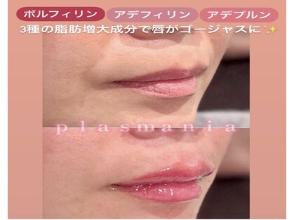 アクシア(Axia)の写真