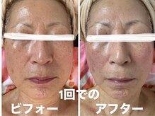 カリアンヌ/温活リンパフェイシャル/小顔