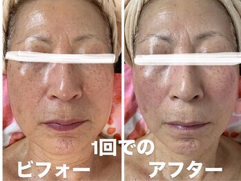 カリアンヌ/温活リンパフェイシャル/小顔