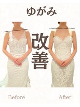 クレバレス/肩甲骨はがしで背中美人に★