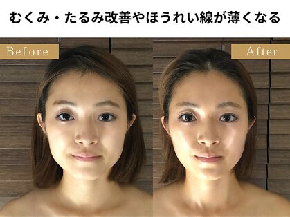 グレースフィオーレ 自由が丘店(gracefiore)の写真