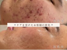 アンパウマン(Anpawman)の雰囲気(結果重視☆★何をしても変わらなかった悩み、ご相談ください♪)