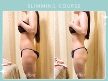 ハノハノ 八代店(HANO HANO)/選べる12種の痩身脂肪撃退☆