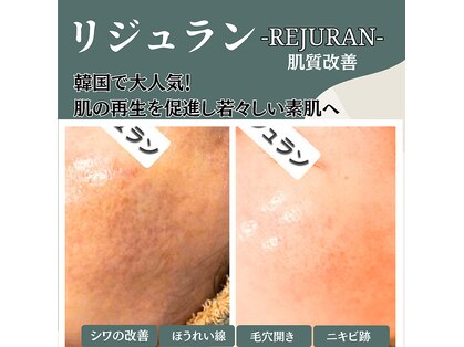 キレナル(KIRENAL)の写真