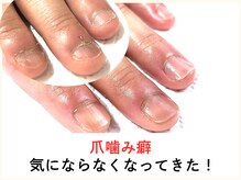 広島深爪専門ネイルサロン　ナッカ/
