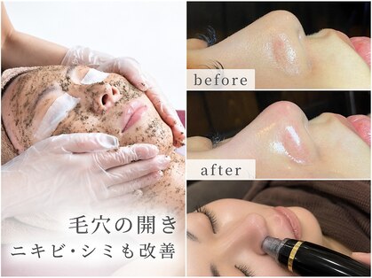 ルクサージュ(LUXAGE)の写真