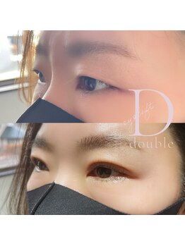 ルークアイビューティ(Luke eye beauty)/まつ毛パーマ　ダブルアイリフト