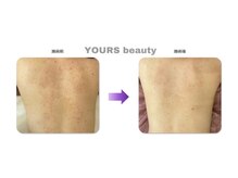 ユアーズ ビューティー(YOURS beauty)/棘あり☆１回