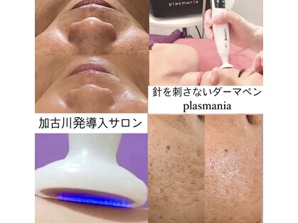コンクパール(CONCH PEARL.)の写真