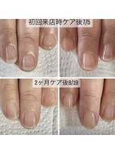 スターネイル(Starnail)/