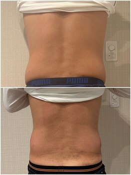 シェリール(CHIRIEUR)/メンズ痩身も人気