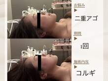 ベレガ 京都店(BELEGA)/◆BeforeAfter◆