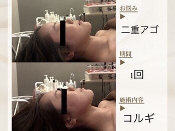 ベレガ 京都店(BELEGA)/◆BeforeAfter◆