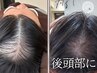 【育毛促進コース/抜け毛・部分のお悩み】¥29000
