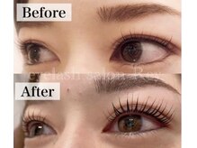 【eyeサロンケアLashaddict】自まつ毛&自眉毛勝負の貴女へ～素っぴん美人革命～（極毛）
