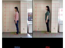 けいのき鍼灸整骨院/姿勢から身体を楽に!整体/肩こり