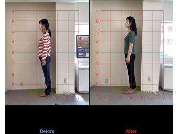 けいのき鍼灸整骨院/姿勢から身体を楽に!整体/肩こり