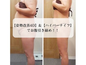 レイプラス イオン卸町店(RAY PLUS)/【before⇒after】お客様の例