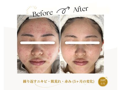 ミラリー(MIRALY)の写真