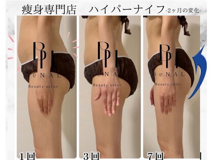 ビナル(BeNAL)の写真