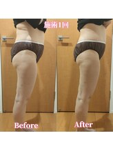 ヨサパーク サーナ 仙川(YOSA PARK Sana)/50代お客様ビフォー⇒アフター