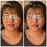 アリス(Alice)