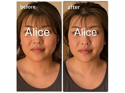 アリス(Alice)の写真
