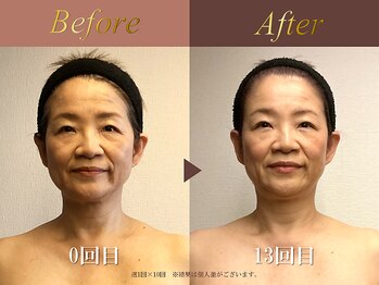 オーシャン(Ocean)/全身美容矯正120分/週1回×13回