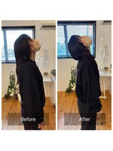 リアルボイス(REAL VOICE)/首の悪さは「顎」で根本改善