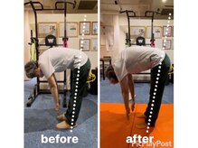 カワル整体 上通り院/反り腰の改善間違ってるませんか