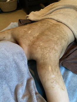 リラ 都城店(Lilas)/ハーブピーリング背中