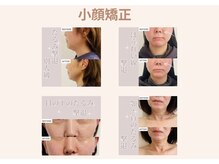 ニコ(nico)の雰囲気（1回の施術で驚きの変化！）