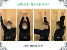 ボディ リセット アンド デザイン(Body Reset & Design)/【施術例】ビフォーアフター