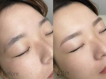 サンリット(SUNLIT)/