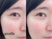 ジラフ(giraffe)/【まつ毛パーマ】立ち上げカール
