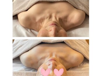 メリア(Mellia)/小顔メソッド