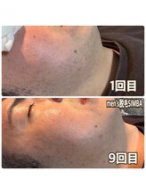 メンズ シンバ(SIMBA)/