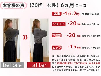 恵整骨院/30代 6ヵ月ダイエット成果