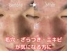 メンズ　【8.9月限定】メンズ肌改善コース　通常新規価格￥8,800→¥5500
